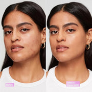 Revlon Illuminance Tinted Serum, Triple Hyaluronic Acid, Evens Out Skin Tone Over Time and Hydrates All Day, SPF 15, 405 H...