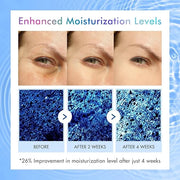 5% Caffeine Eye Serum, Under Eye Roller Cream for Dark Circles, Puffiness, Bags Under Eyes - 360° Massage Ball Cream for W...