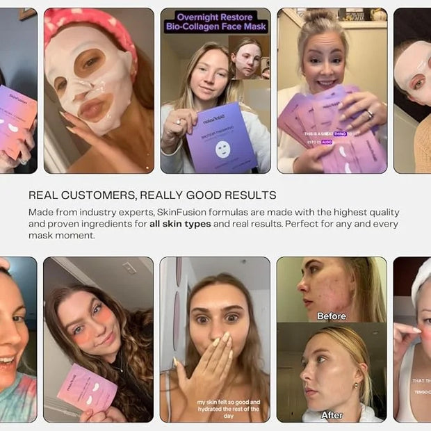 Collagen Under Eye Mask Patches (Anti-Aging + Firming 20 Pairs) with Niacinamide + Peptides - Anti-Aging, Fine Lines, Wrin...