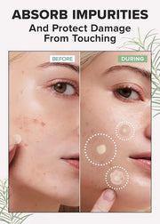 I DEW CARE Skin Care Set - Starlit Kitten & Meet Your Patch & Proper Popper | Eye Patches, Variety Pimple, Glass Skin, Hyd...
