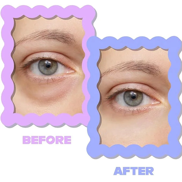 ULTIMATE HYDROGEL EYE MASK 28 Pairs Under Eye Patches, Rejuvenate Eye Area Reduce Dark Circles Puffiness, Tiredness Bags, ...