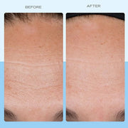 First Aid Beauty - Firming Collagen Cream with Peptides & Niacinamide, Ultra-Rich Plumping Moisturizer, Hydrates & Visibly...