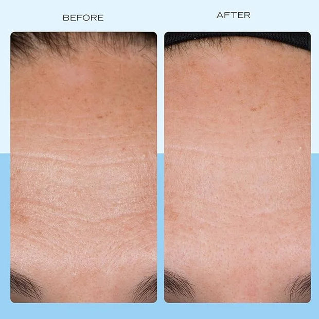 First Aid Beauty - Firming Collagen Cream with Peptides & Niacinamide, Ultra-Rich Plumping Moisturizer, Hydrates & Visibly...