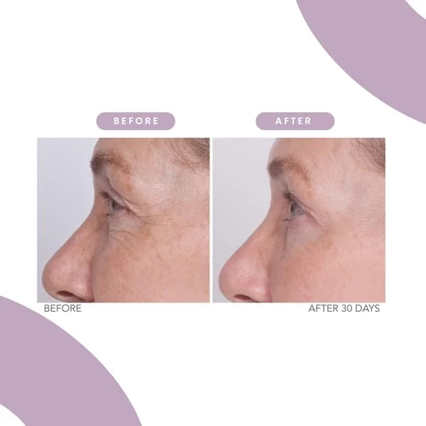 Serious Skincare - Reverse Lift Eye Cream Moisturizer with Peptides - Skin Firming Wrinkle Formula - Temporarily Lift & Fi...