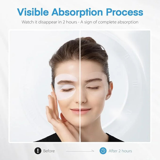 Dongyu Collagen Under Eye Patches: Deep Real Collagen Overnight Eye Gels Mask With Caffeine Peptides Niacinamide - Dark Ci...