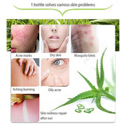 300 ML Natural Aloe Vera Gel -Organic Moisturizing Cream, Soothing and Hydrating, Sunburn and Scar Repair, Care for Face B...