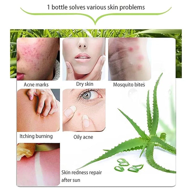 300 ML Natural Aloe Vera Gel -Organic Moisturizing Cream, Soothing and Hydrating, Sunburn and Scar Repair, Care for Face B...