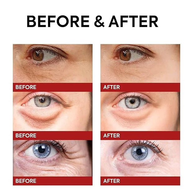 Instant Eye & Face Lift Cream: Rapid Under Eye Bags Wrinkle Smile Lines Forehead Lines Remover - Temporary Firming & Tight...