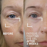 Dr. Brandt iD-STRESS Fatigue Fighting Eye Gel - 0.5 fl oz, Pack of 2 - Rapidly Diminishes Signs of Dryness, Fatigue & Dark...