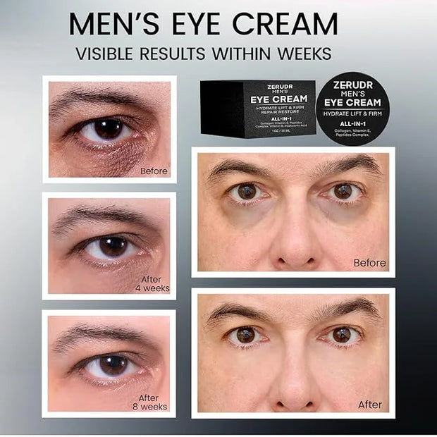 Men’s under Eye cream: all-in-1 Eye Bags, Dark Circles, and Puffiness reduce- Men’s eye care for hydrate, firm & repair - ...