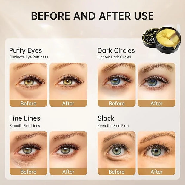 PITHER Under Eye Patches for Dark Circles, Eye Masks for Puffy Eyes Wrinkles Under Eye Bags Firmness 30 Pairs Skin Treatme...