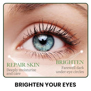 Under Eye Patches for Dark Circles, Puffy Eyes and Dark Circles, Under Eye Mask Dark Circles Under Eye Treatment, Aloe Ver...