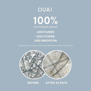 OUAI Detox Shampoo (10 fl oz) & Anti-Dandruff Deluxe Size (1 fl oz) Bundle - Soothing, Clarifying Shampoo Set for Dry, Fla...