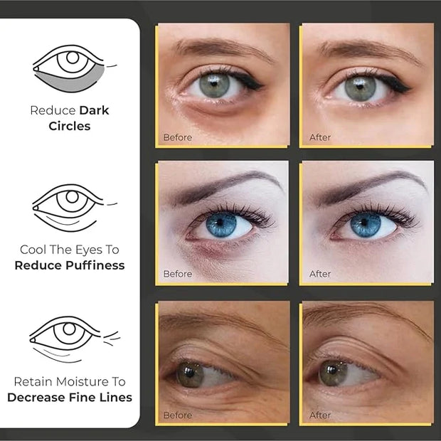 Under Eye Patches for Puffy Eyes and Dark Circles | Infused Gel Mask Patches for Dark Circle Undereye Support of Bags & Pu...