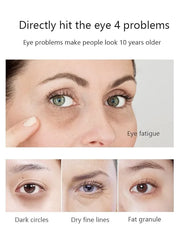 Senana MarinaUnder Eye Masks, Eye Lines And Moisturizing Eye Patches, Moisturizing, Nourishing, Improving Eye Bags, Dark E...