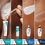 CeraVe Acne Skin Care Set, 5oz Acne Foaming Cream Cleanser + 1oz Resurfacing Retinol Serum + 2oz AM Facial Moisturizing Lo...