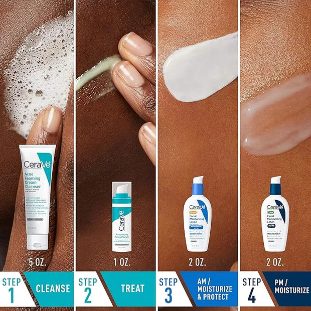CeraVe Acne Skin Care Set, 5oz Acne Foaming Cream Cleanser + 1oz Resurfacing Retinol Serum + 2oz AM Facial Moisturizing Lo...