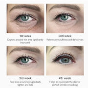 Under Eye Patches - 5 in 1 Under Eye Mask Hyaluronic Acid & Collagen,Under Eye Face Mask,Dark Circles and Puffy Eyes, Unde...