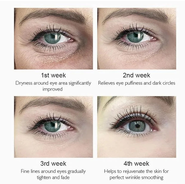 Under Eye Patches - 5 in 1 Under Eye Mask Hyaluronic Acid & Collagen,Under Eye Face Mask,Dark Circles and Puffy Eyes, Unde...
