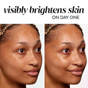 Olay Bright & Even Vitamin C with Lactic Acid Face Moisturizer, 2 oz Lightweight Brightening Face Cream for Uneven Skin To...