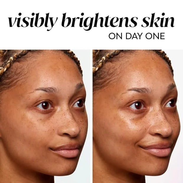 Olay Bright & Even Vitamin C with Lactic Acid Face Moisturizer, 2 oz Lightweight Brightening Face Cream for Uneven Skin To...