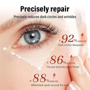 Retinol Repair Eye Cream，Reduces the appearance of dark circles，Stretch wrinkles at the corners of the eyes，moisturize and...