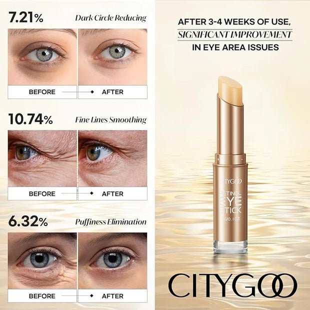 CITYGOO Retinol Eye Stick With Collagen, Hyaluronic Acid For Dark Circle, Under Eye Cream Anti Aging, For Puffiness and Ba...