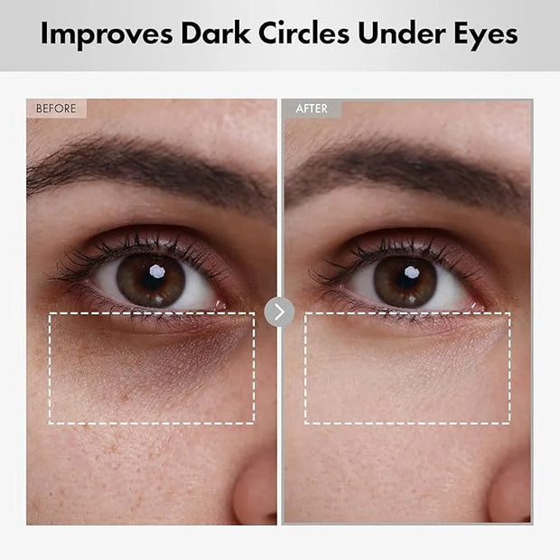 Hyaluron Lifting Eye Cream, Hyaluronic Acid, 5% arbutin, Niacinamide for Puffy Eyes, Dark Spot and Fine Lines, Hydrating U...
