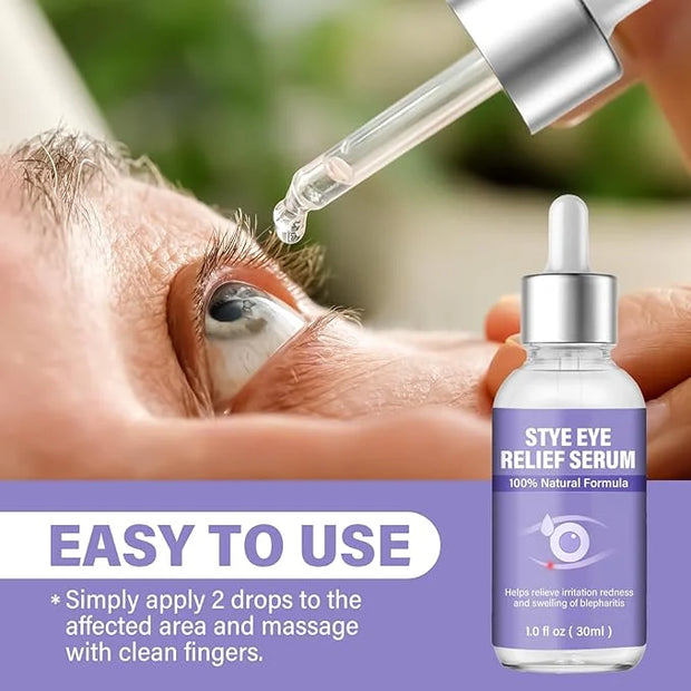 Stye Eye Treatment, Natural Stye Relief Serum, Gently Cleanses Lashes and Eyes, Chalazion and Blepharitis Treatment，Reliev...