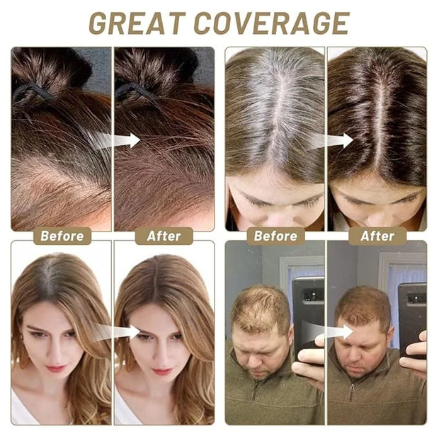 SOVONCARE Instantly Hairline Powder, Hairline