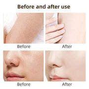 Snail Mucin Skincare Bundle – Complete 4-Step Routine with Snail Mucin Serum, Toner, Gel Cleanser, and Moisturizing Cream ...