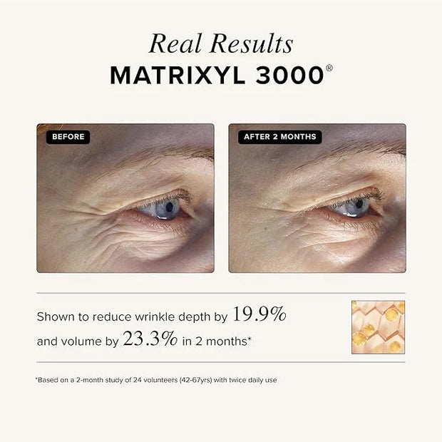 Asterwood Triple Repair Matrixyl 3000 + Argireline + Hyaluronic Acid + Vitamin C Serum for Face - Anti-Aging, Collagen Boo...