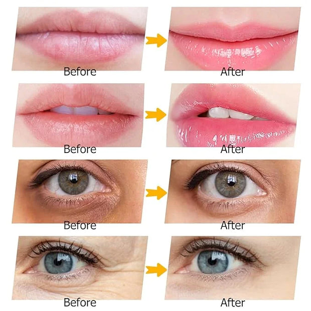 40 Pairs Peach Red Lip Masks & Eye Masks, 24K Gold Gel Collagen Eye Patches for Puffy Eyes, Dark Circles, Wrinkles and Eye...