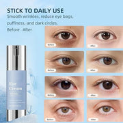Retinol Under Eye Cream, Anti-aging Eye Cream for Eye Bags, Retinol Eye Cream for Dark Circles, Puffiness and Wrinkles, Su...
