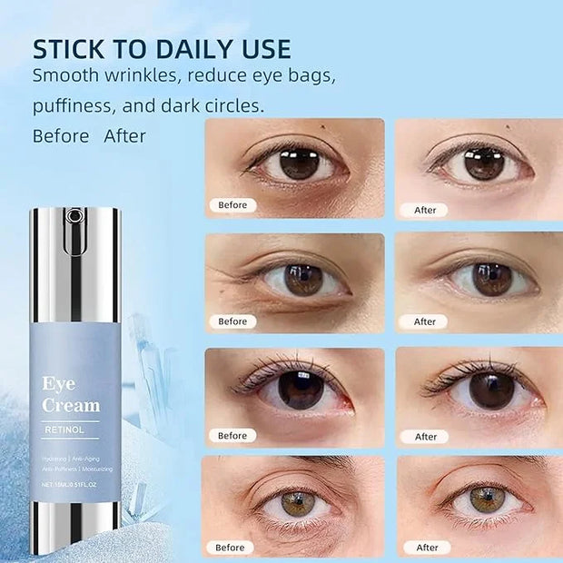 Retinol Under Eye Cream, Anti-aging Eye Cream for Eye Bags, Retinol Eye Cream for Dark Circles, Puffiness and Wrinkles, Su...