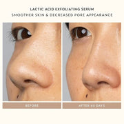 SHANI DARDEN SKIN CARE Sculpt & Firm Travel Kit, Facial Sculpting Wand, Attachments, Retinol Reform & Lactic Serums, Pepti...