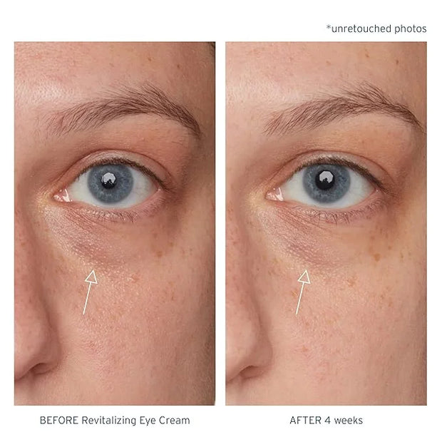 Santo Remedio, Piel Eterna, Revitalizing Eye Cream, Illuminating Eye Cream, Helps Reduce Dark Circles, Contains Marina Alg...
