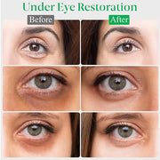 EyeGLO Caffeine Eye Cream for Dark Circles, Eye Bags, and Puffiness | UnderEye Treatment for Women with Peptides, Antioxid...