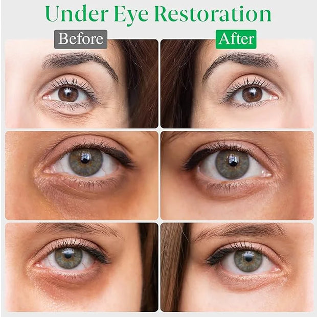 EyeGLO Caffeine Eye Cream for Dark Circles, Eye Bags, and Puffiness | UnderEye Treatment for Women with Peptides, Antioxid...