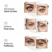 24k Gold Under Eye Collagen Patches, Reduce Puffy Eyes & Dark Circles, Illuminate Tired Eye Masks - Firms, Brightens, Ener...