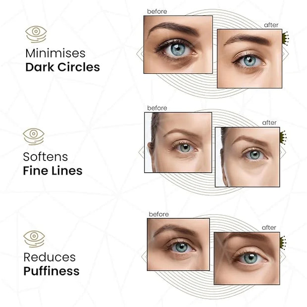 24k Gold Under Eye Collagen Patches, Reduce Puffy Eyes & Dark Circles, Illuminate Tired Eye Masks - Firms, Brightens, Ener...