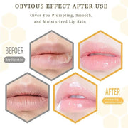 Lip Plumper Lip Mask Set, Bee Exfoliator
