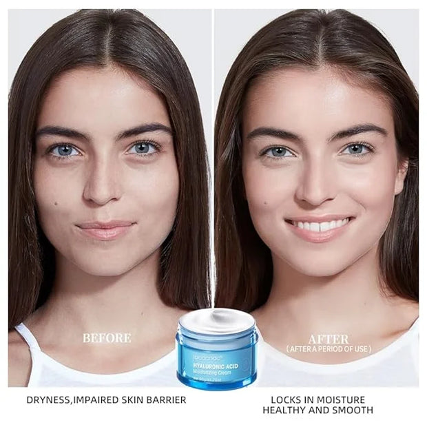 Hydro Boost Hyaluronic Acid Moisturizing Cream, Oil-Free,Face Moisturizer Exclusive For Dry Skin,Long lasting Hydro Boost ...
