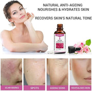 Rose Essential Oil, Face Rose Oil, Moisturizer Rose Oil, Anti Ageing & Anti Wrinkle Serum, Rose Oil for Face, Skin Care, 1...