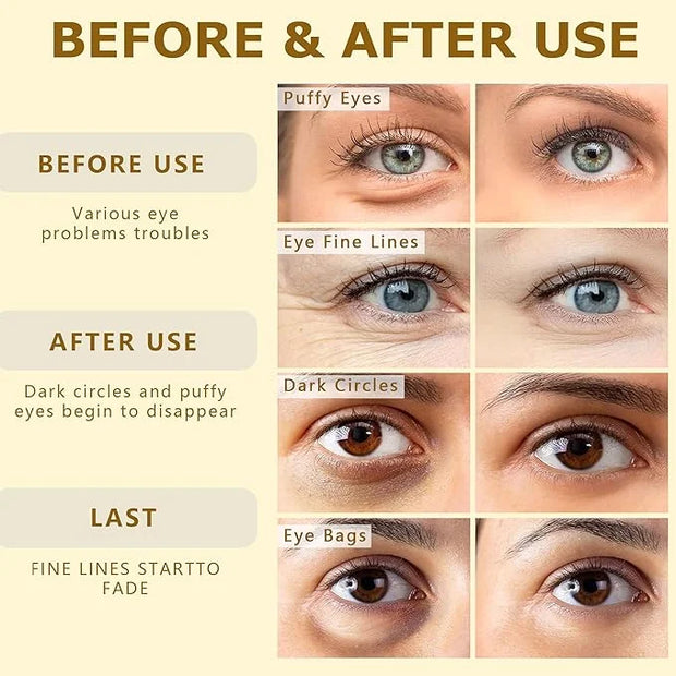 24k Gold Vitality-Fill Eye Patches (30 Pairs)|Anti-Aging Hydra-Gel Under Eye Patches, Boost Lift & Firm the Look of the Ey...