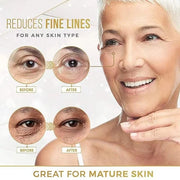 Hyaluronic Acid Eye Patch (Removes Dark Circles, Eye Bags, Eye Care, Wrinkles, Puffy Eyes, Skin Cushioning) - Anti-Aging M...