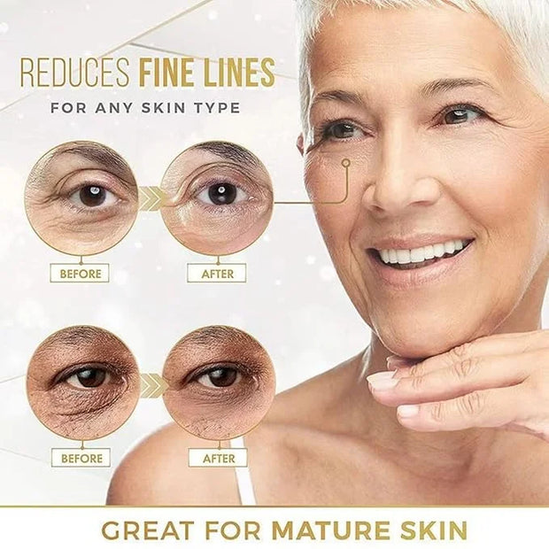 Hyaluronic Acid Eye Patch (Removes Dark Circles, Eye Bags, Eye Care, Wrinkles, Puffy Eyes, Skin Cushioning) - Anti-Aging M...