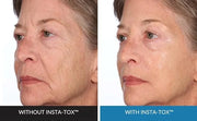 INSTA-TOX Facial Firming Wrinkle Smoothing Serum & Reverse Lift Firming Eye Cream Set - Tightener for Lines, Deep Wrinkles...