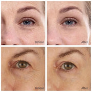 30 Pairs Retinol Collagen Under Eye Patches for Dark Circles Puffiness Wrinkles and Bags, Skin Treatment Pads for Women Gi...