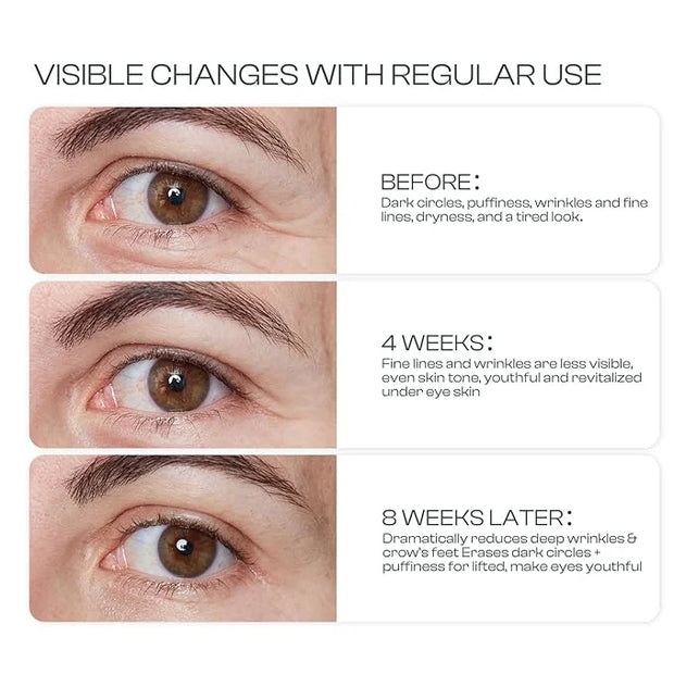 Eye Cream for Dark Circles: Caffeine Eye Cream with Hyaluronic Acid Vitamin E collagen For anti-aging dark circles eye bag...